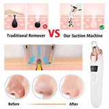 Electric Blackhead Remover | Vacuum Acne & Pore Cleaner | 5 Heads Suction Machine | Skin Care & Exfoliating Tool - Detail View 3