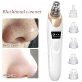 Electric Blackhead Remover | Vacuum Acne & Pore Cleaner | 5 Heads Suction Machine | Skin Care & Exfoliating Tool - Detail View 4
